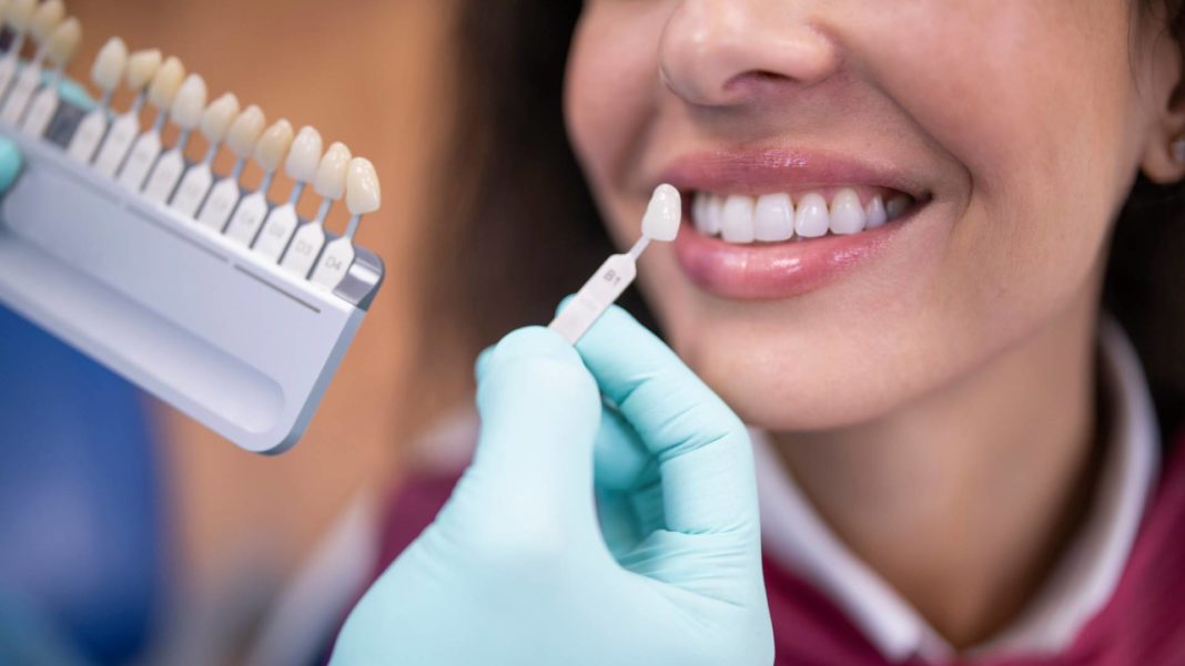 Blanqueamiento dental: descubre los riesgos de hacerlo sin indicación médica