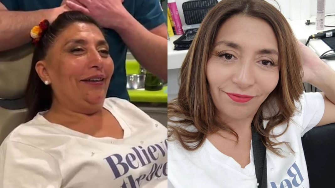 ¡Increíble transformación! Pincoya se somete a retoque facial con bótox