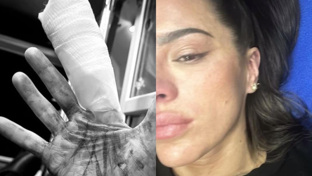 ¡Impactante! Gianella Marengo sufre un grave accidente en la grabación de “Top Chef Vip”