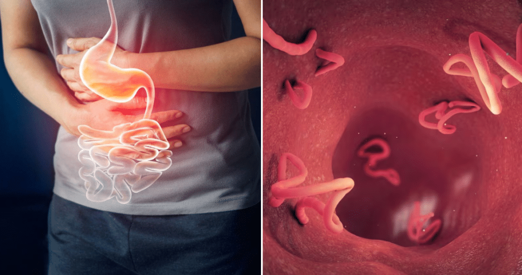 ¿Deberías desparasitarte como lo hacen en otros países? Experto revela la verdad sobre la salud de los chilenos