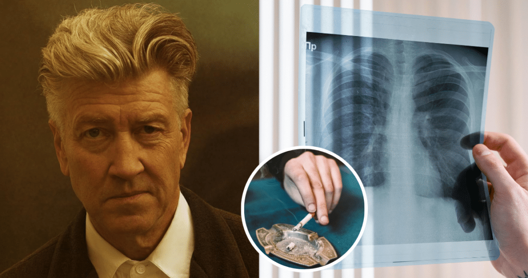 Enfisema Pulmonar: La Enfermedad que Mantiene a David Lynch Confinado en Casa