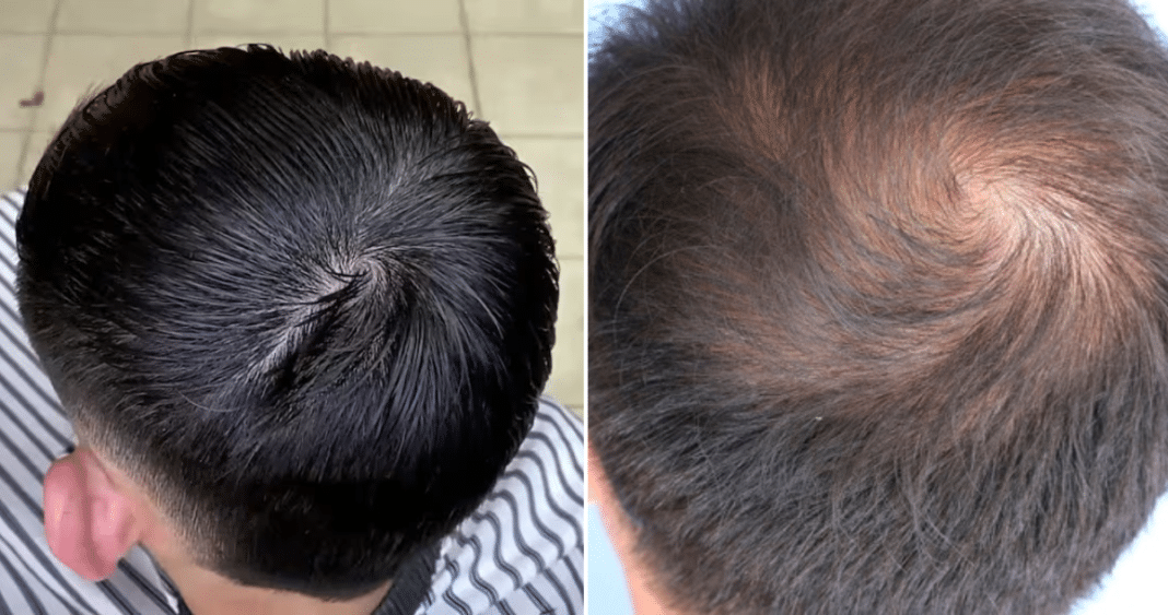 ¡Descubre cómo los Remolinos en el Cabello Revelan Secretos del Hemisferio! Investigadores Chilenos Ganan Prestigioso 'Antinobel'