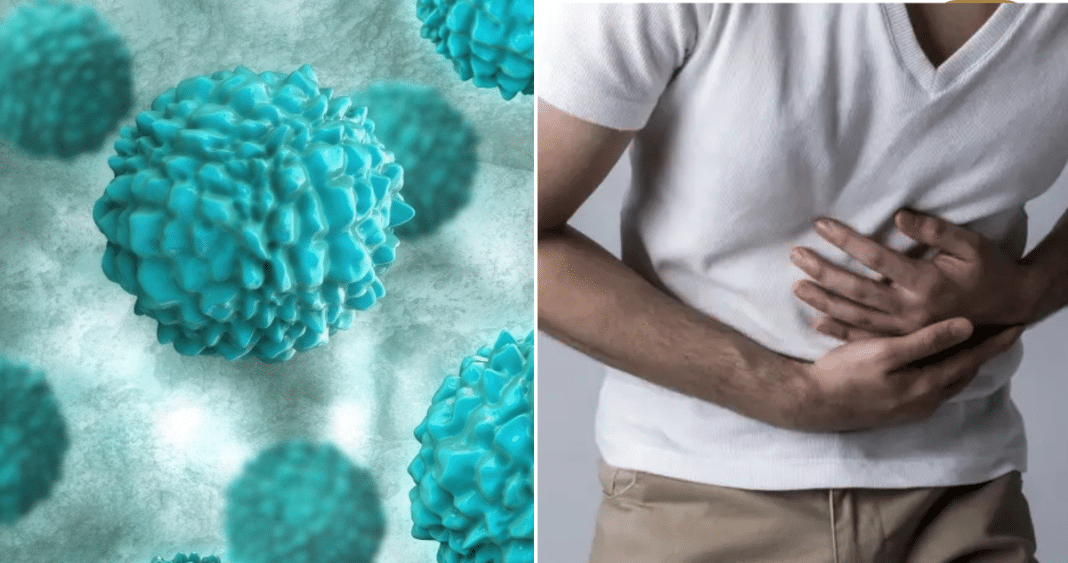 Brote de Norovirus en EE. UU.: Cómo Identificarlo y Prevenirlo