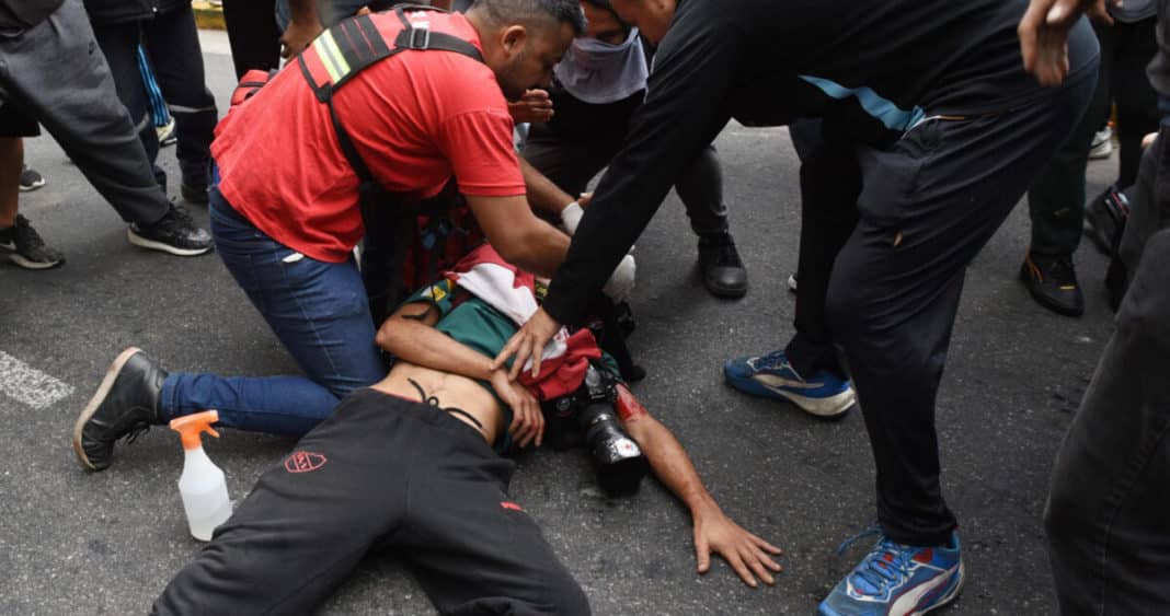 Fotógrafo Herido Gravemente en Protestas de Jubilados en Argentina