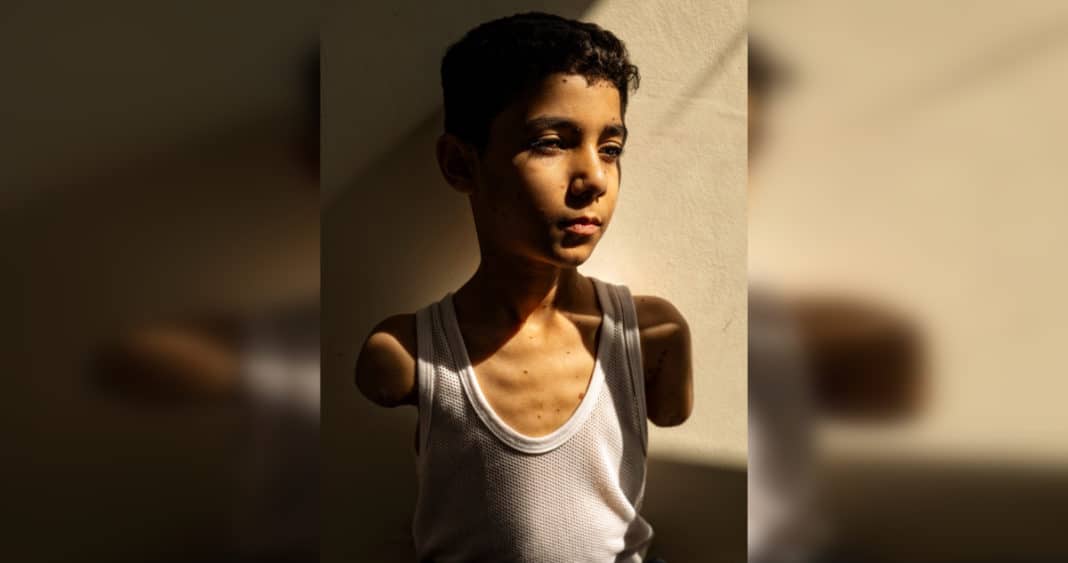 La Foto del Año que Conmueve al Mundo: La Lucha de un Niño Palestino por Sobrevivir