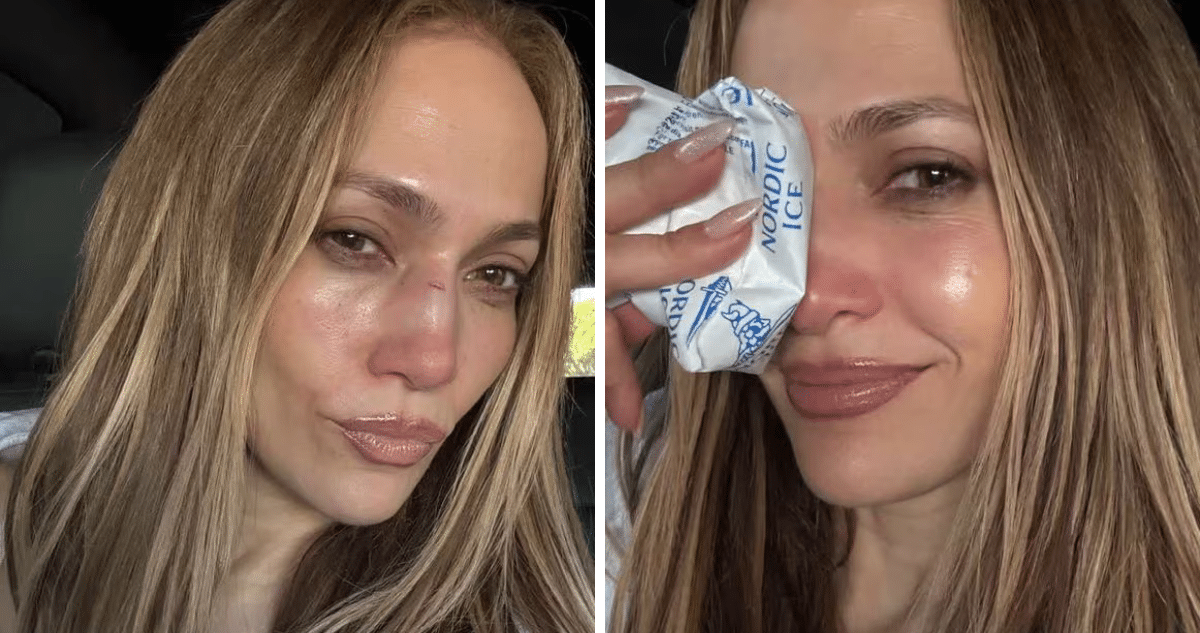 La Nariz de Jennifer López: De Accidente a Recuperación Impecable