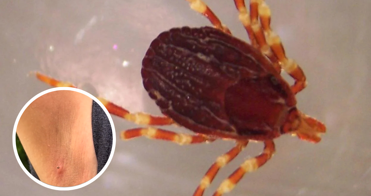 Garrapatas en Alemania: Un Peligro Oculto que Acecha a los Residentes