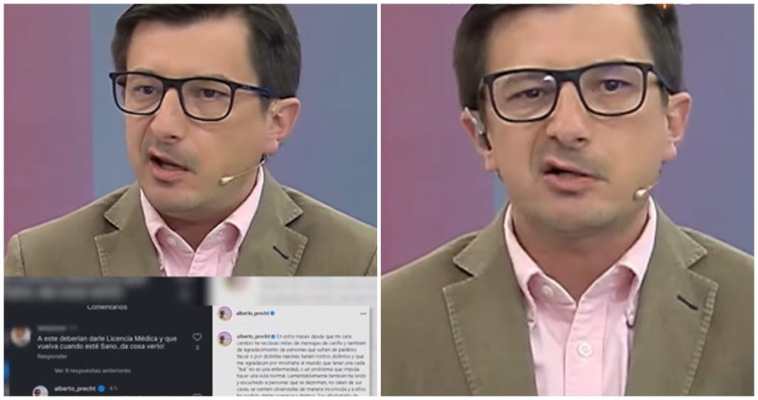 La Inspiradora Lucha de Alberto Precht: Enfrentando la Parálisis Facial con Fortaleza y Determinación