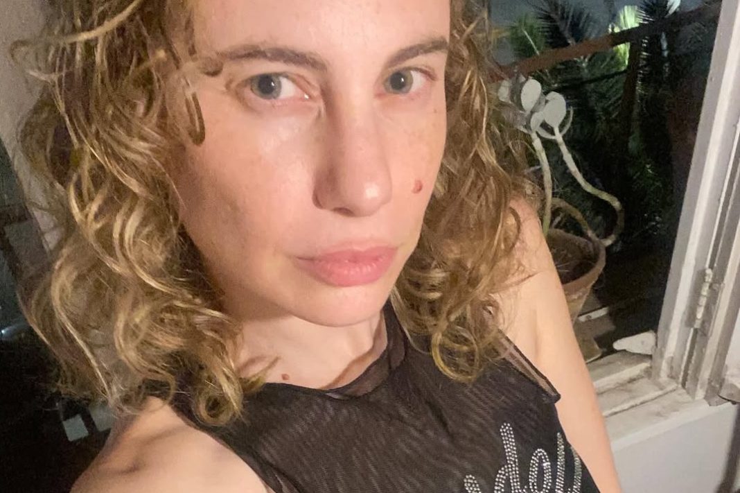 La Valiente Lucha de Li Fridman: Superando la Alopecia con Fortaleza y Resiliencia