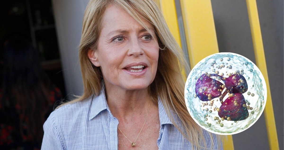 Neutropenia: Cómo Cecilia Bolocco Enfrenta la Debilitación de su Sistema Inmune