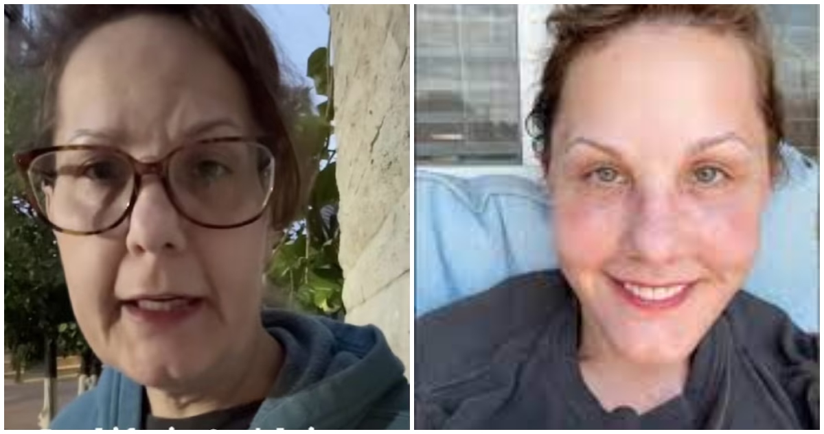 De Obesa a Rejuvenecida: La Increíble Transformación de Michelle Tras Cirugía Estética en Guadalajara