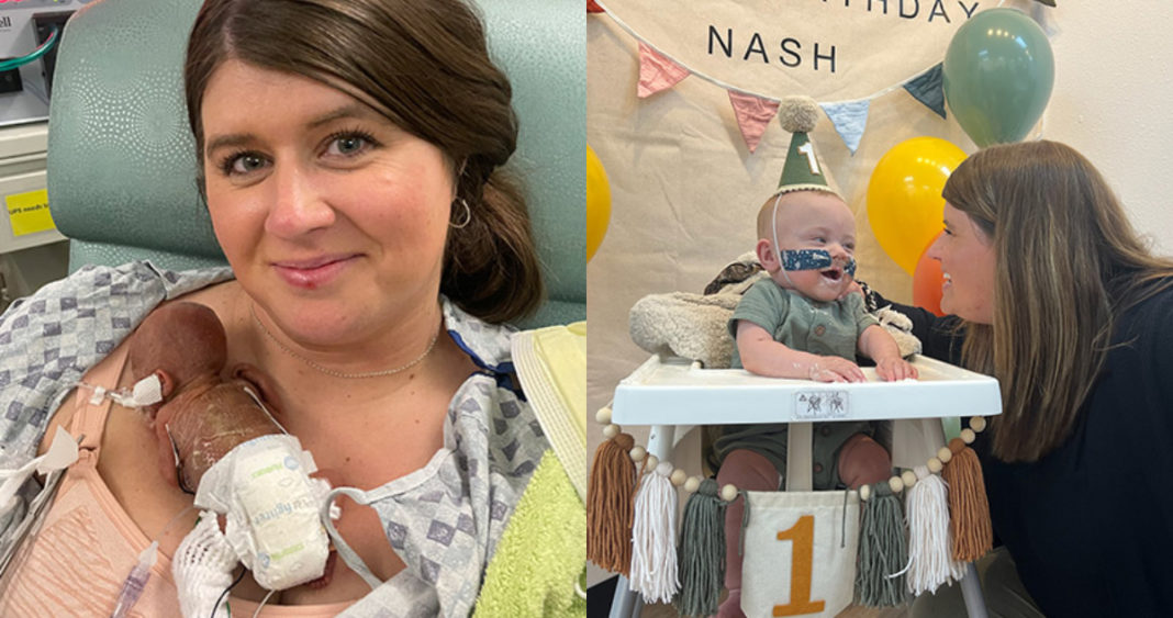 El Milagro de Nash: El Bebé Más Prematuro del Mundo Celebra su Primer Año