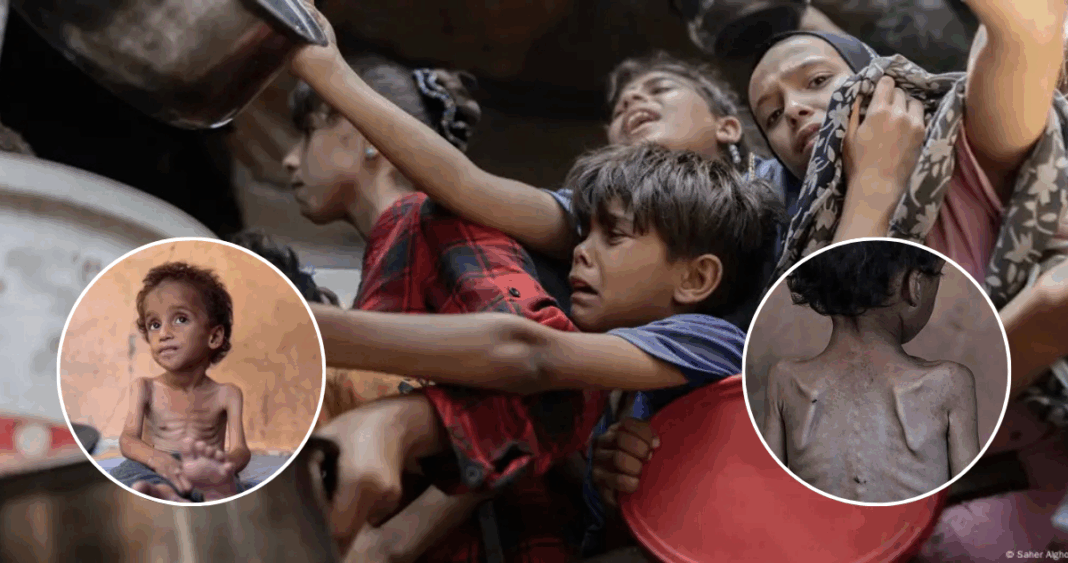 Hambruna en Gaza: Imágenes revelan la devastadora crisis humanitaria