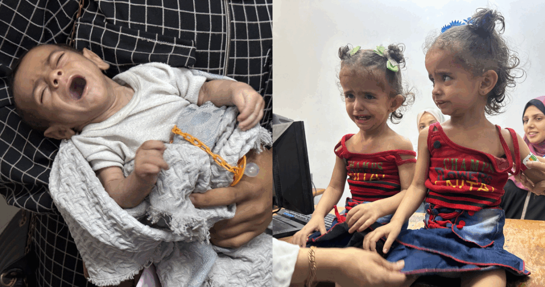 Hambruna en Gaza: Muertes por Desnutrición Alcanzan Cifras Alarmantes