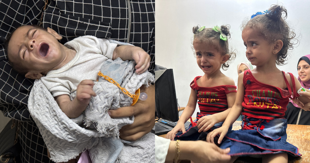 Hambruna en Gaza: Muertes por Desnutrición Alcanzan Cifras Alarmantes