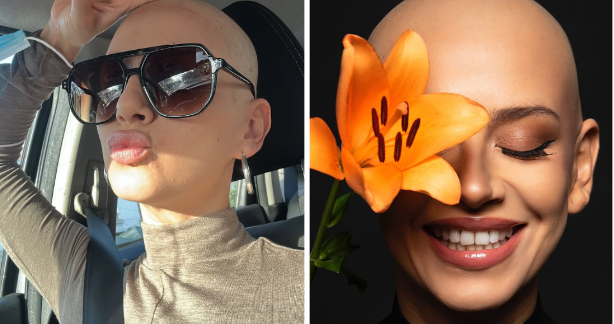Karla Melo: Una Batalla Emocional Contra el Cáncer, Contada con Dignidad y Fortaleza