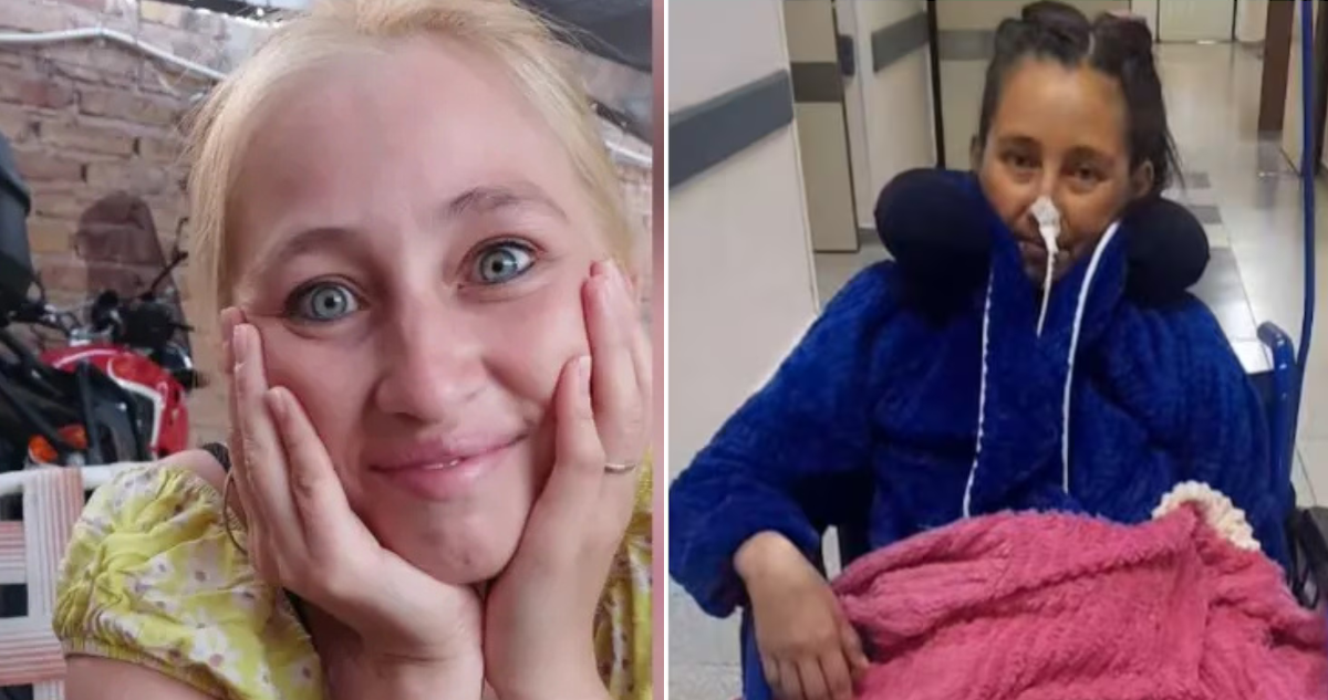 Tragedia Médica: Mujer Sufre Amputación y Trasplante de Corazón Tras Cirugía Fallida