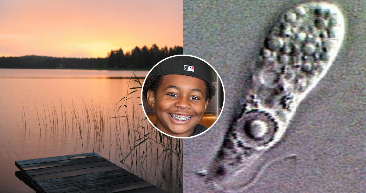 Tragedia en el Lago Murray: Niño muere por la letal