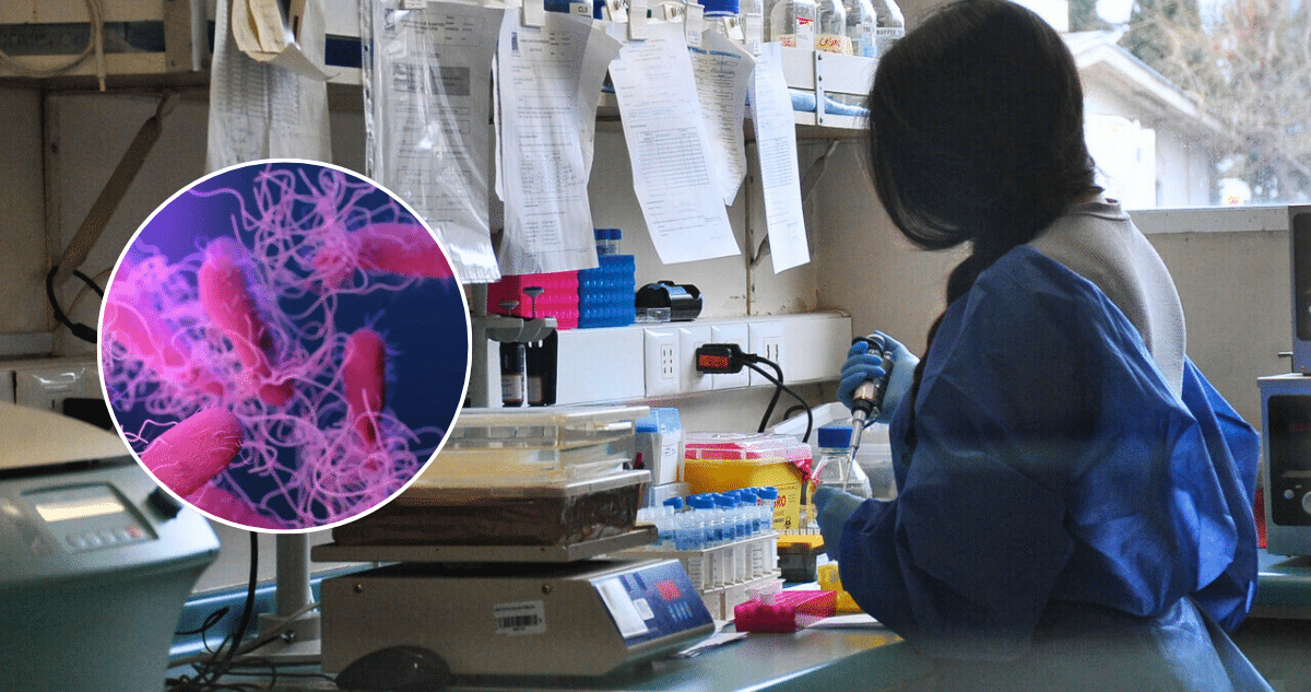 Alerta en Luisiana: Infecciones Mortales por Bacteria