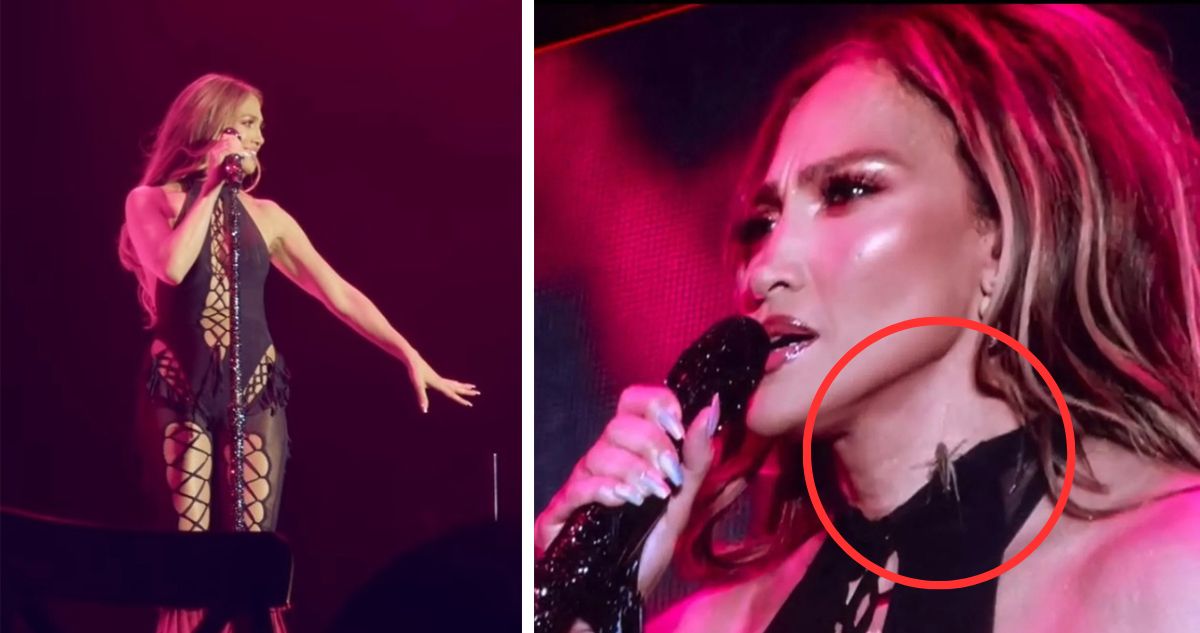Cuando un Grillo Interrumpe el Show: La Placidez de Jennifer Lopez