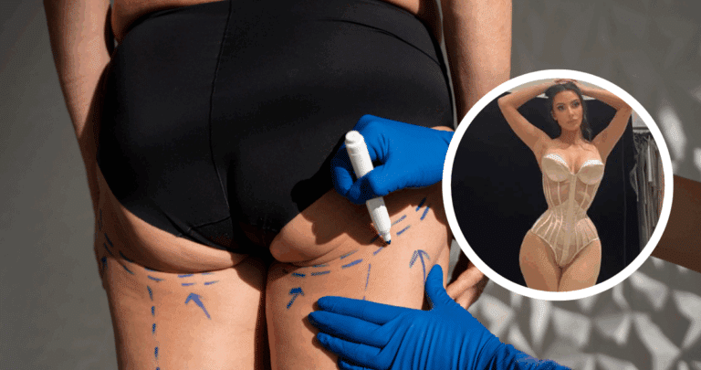 El Inesperado Efecto Secundario del Levantamiento de Glúteos: Cuando la Belleza Tiene un Precio