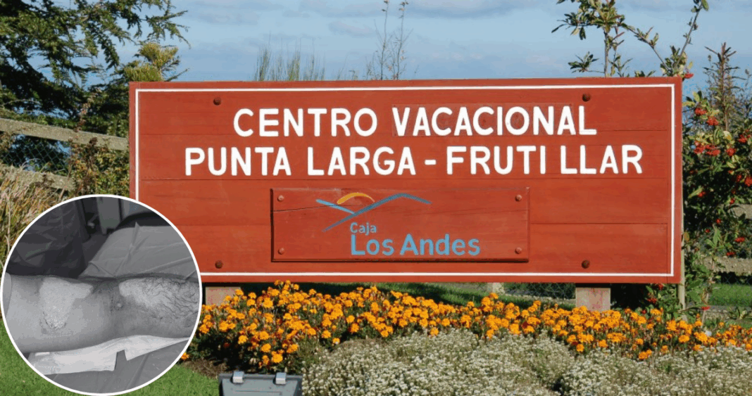Pesadilla en el centro turístico: Familia sufre graves quemaduras por duchas de agua hirviendo