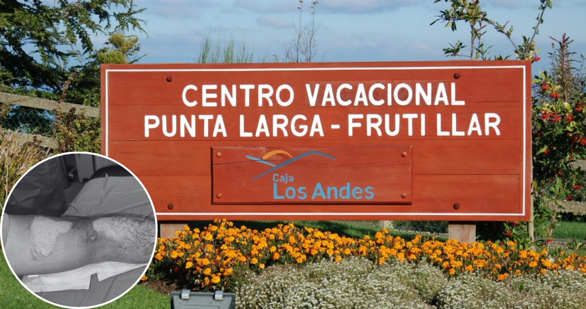 Pesadilla en el centro turístico: Familia sufre graves quemaduras por duchas de agua hirviendo