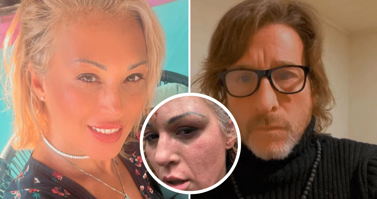 ._temp_Ariela Medeiros, ex Mekano, sobrevive a brutal ataque de su pareja el agresor sigue prófugo Ariela Medeiros, ex Mekano, sobrevive a brutal ataque de su pareja: el agresor sigue prófugo