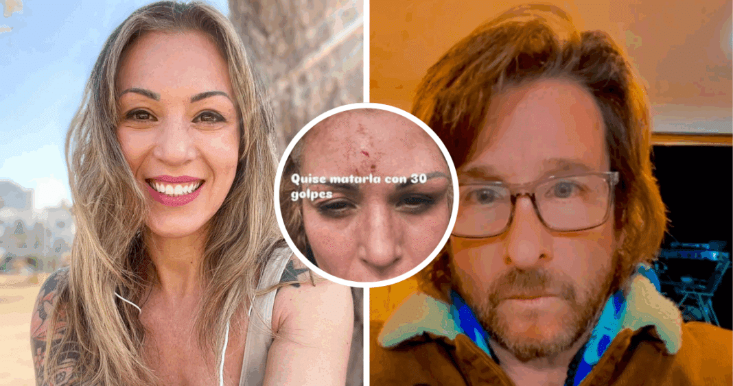 Brutal Golpiza a Ariela Medeiros: Pareja Fugitiva Intensamente Buscada