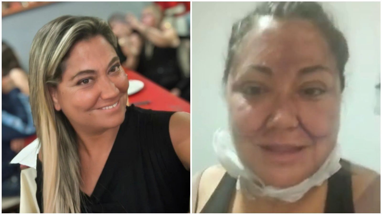 Denisse Campos Deslumbra Tras Cirugía Estética: La Foto Que Cautivó a Sus Seguidores