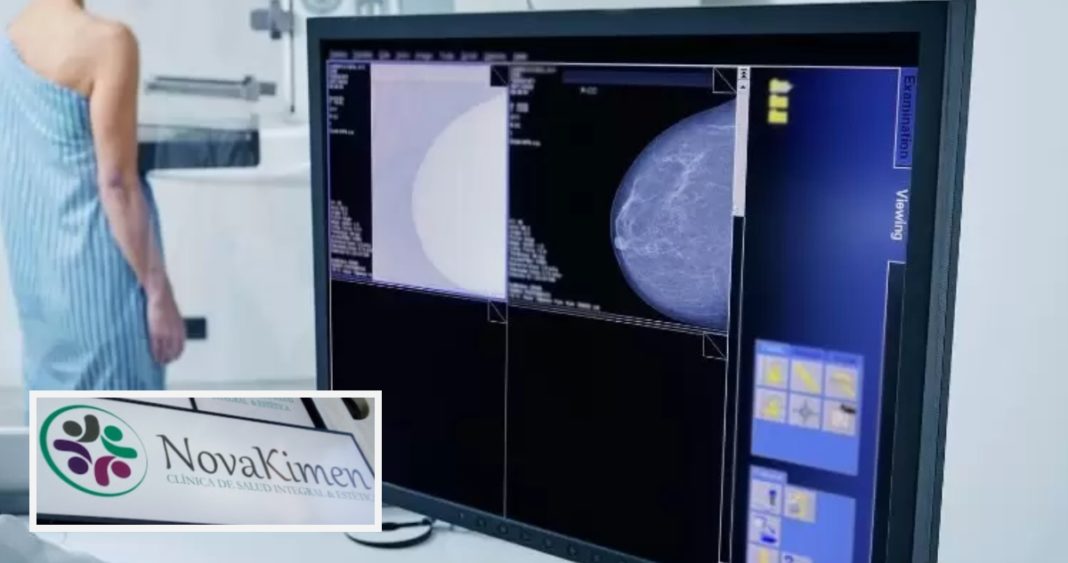 Escándalo de Mamografías Falsas: Más de 1.300 Mujeres Afectadas en Bío Bío