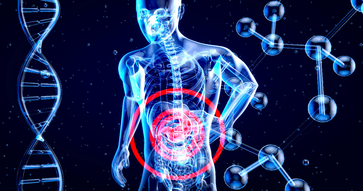 Estilo de vida moderno: el factor clave detrás del aumento de cáncer gástrico en jóvenes