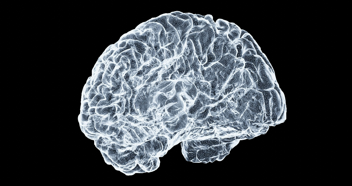 Inteligencia Artificial Predice Alzheimer con Precisión Sorprendente