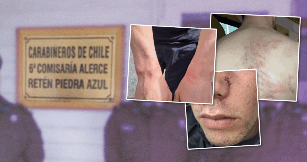 Joven con TEA denuncia agresión y amenazas de violación por parte de Carabineros