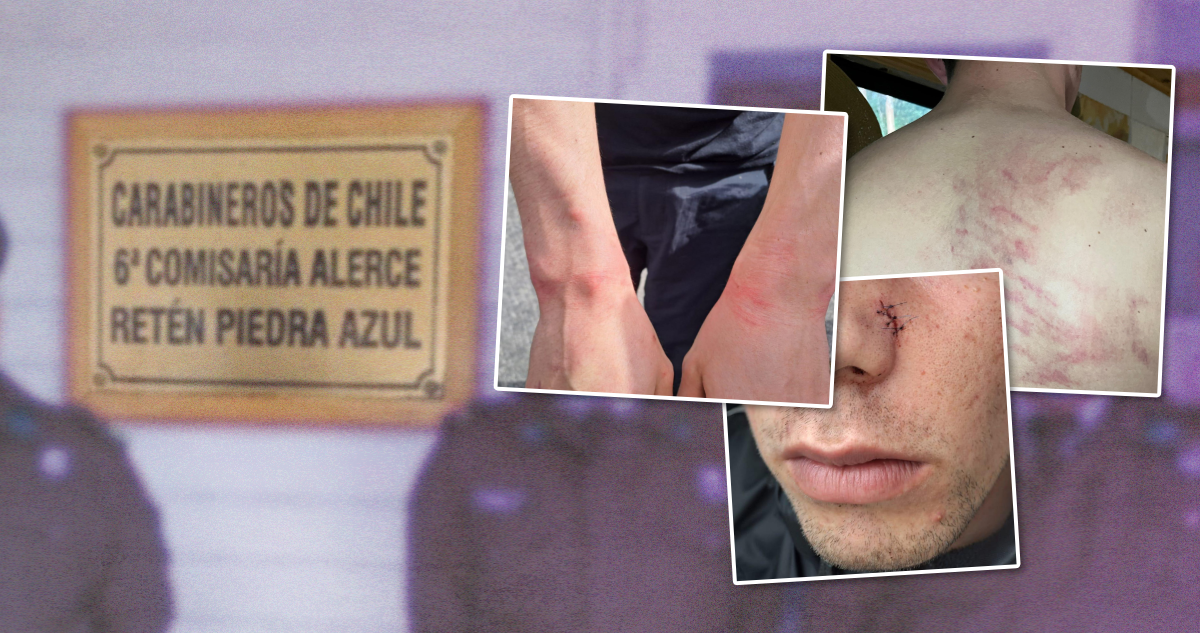 Joven con TEA denuncia agresión y amenazas de violación por parte de Carabineros
