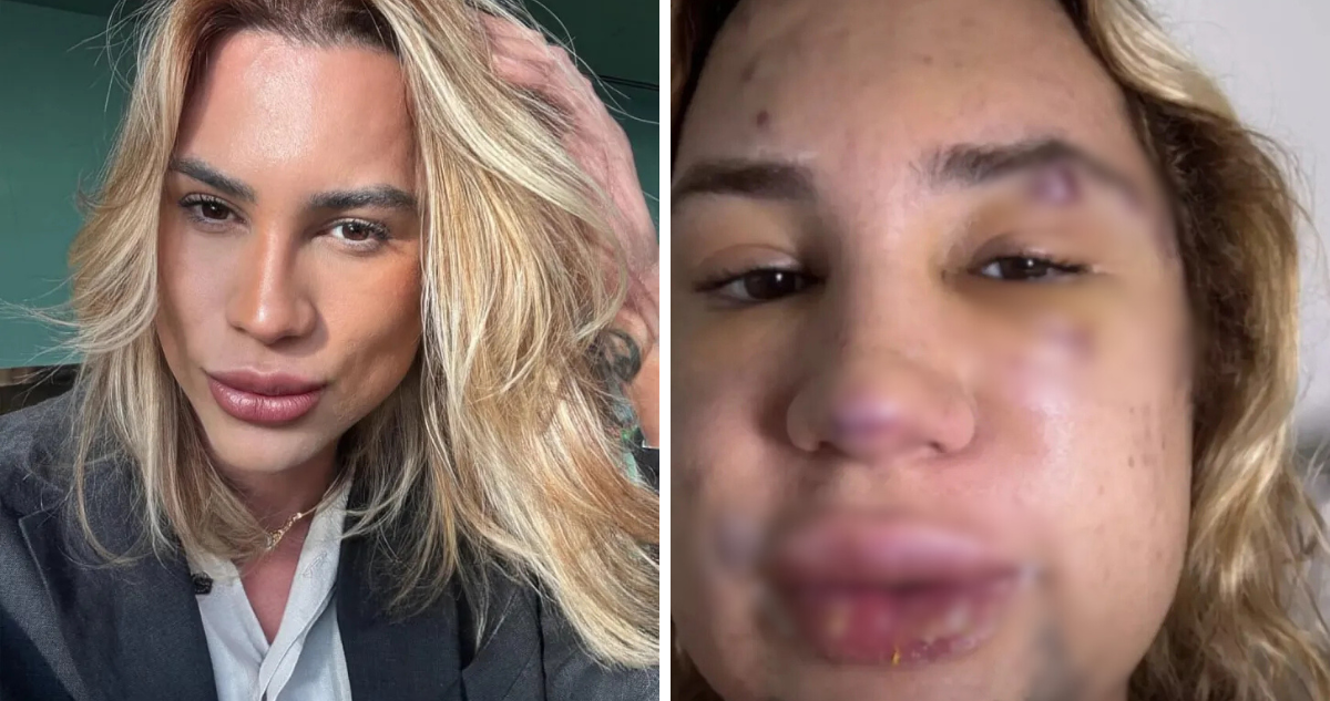 Trágica Muerte de Influencer tras Cirugía