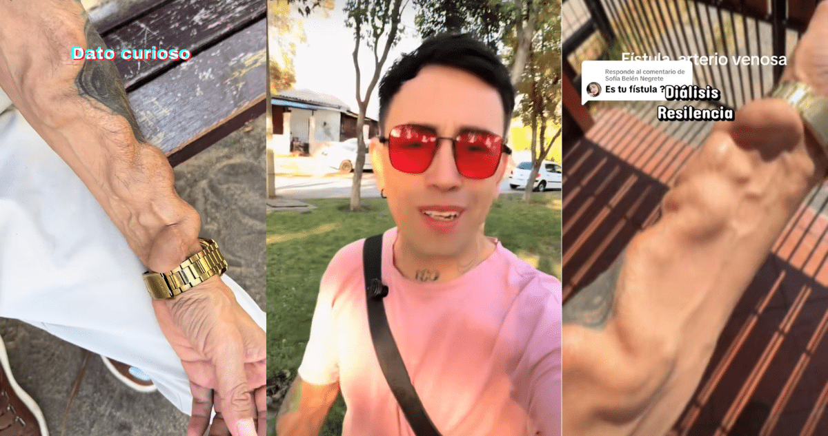 ._temp_Joven chileno relata cómo una muela infectada casi le cuesta la vida Joven chileno relata cómo una muela infectada casi le cuesta la vida